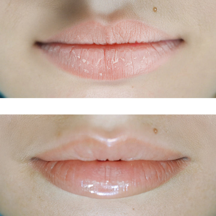 Healing Lip Mask