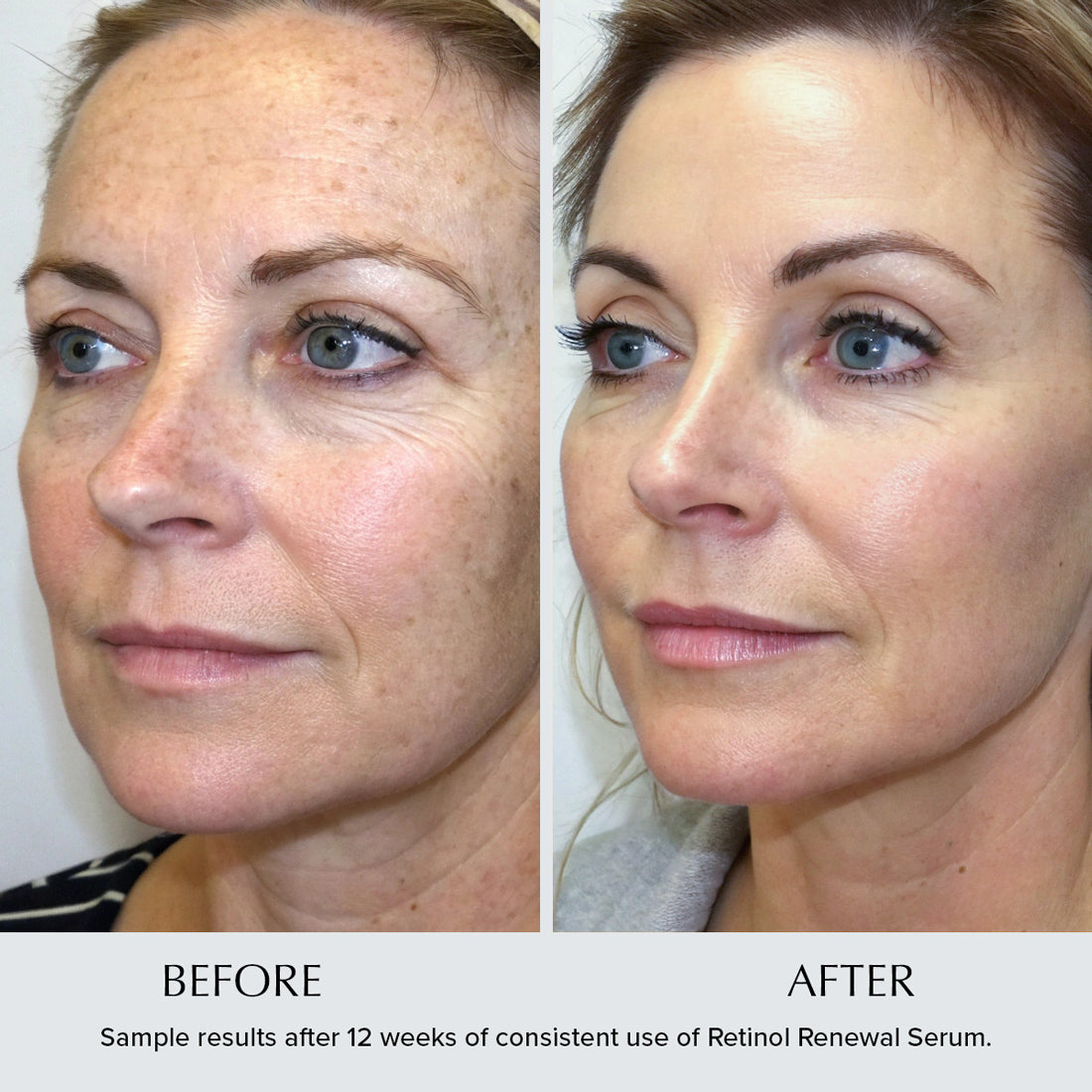 Retinol Renewal Anti-Wrinkle Night Serum