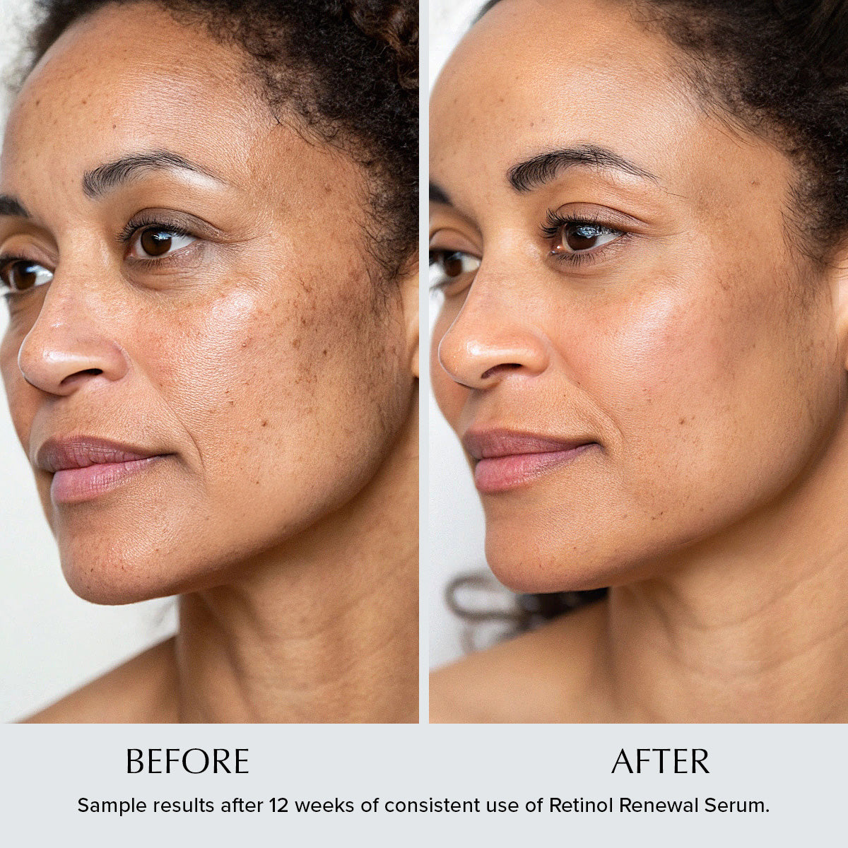 Retinol Renewal Anti-Wrinkle Night Serum