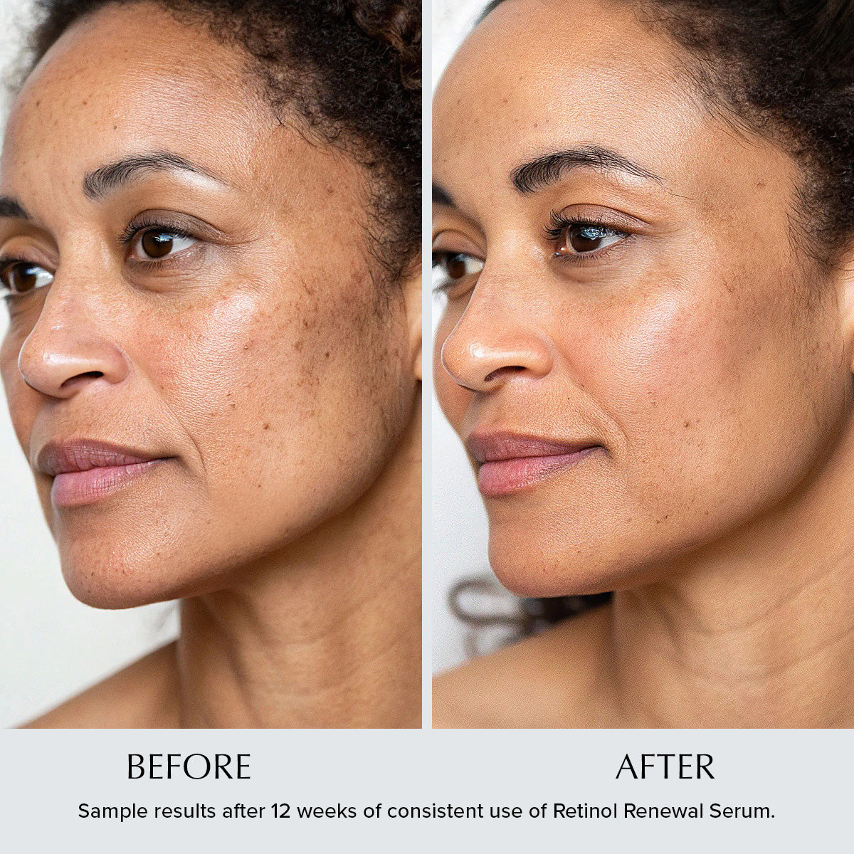 Retinol Renewal Anti-Wrinkle Night Serum