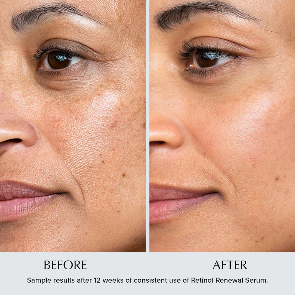 Retinol Renewal Anti-Wrinkle Night Serum