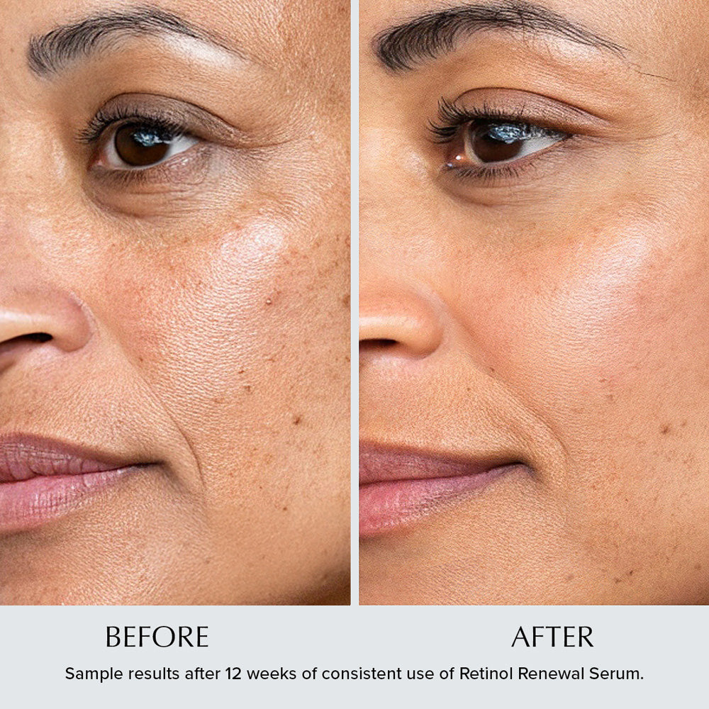 Retinol Renewal Anti-Wrinkle Night Serum