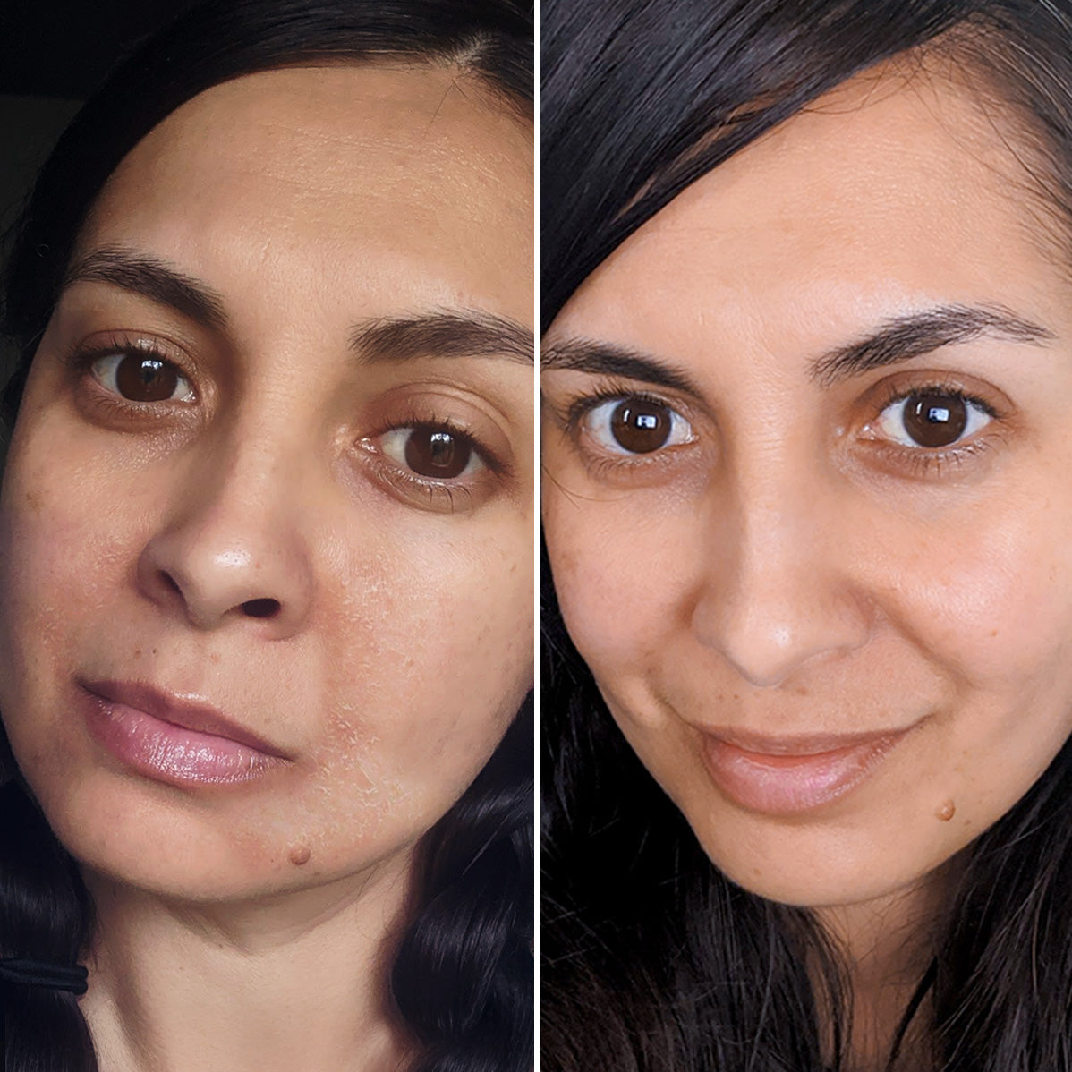 before/after results using born firm moisturizer