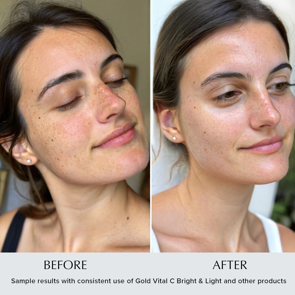 Gold Vital C3 Bright & Light 1oz