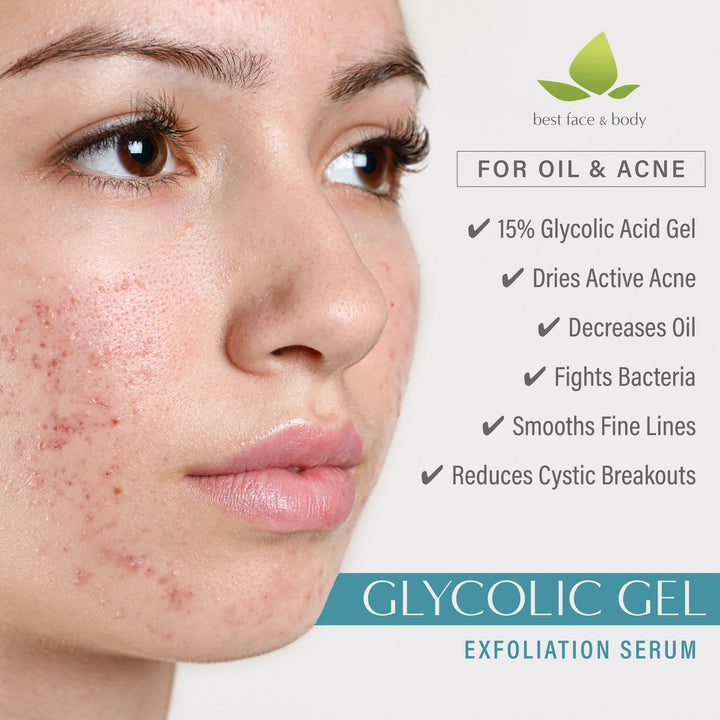 Glycolic Gel Exfoliation Serum 1 oz Benefits