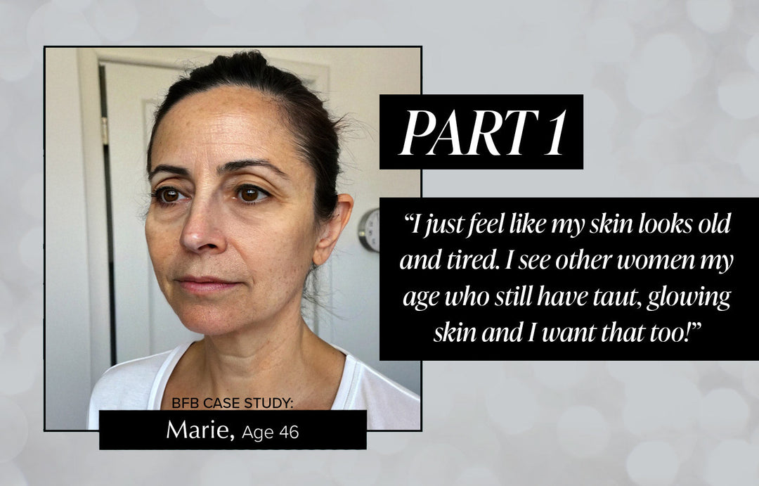 Marie's Skincare Journey - Part I