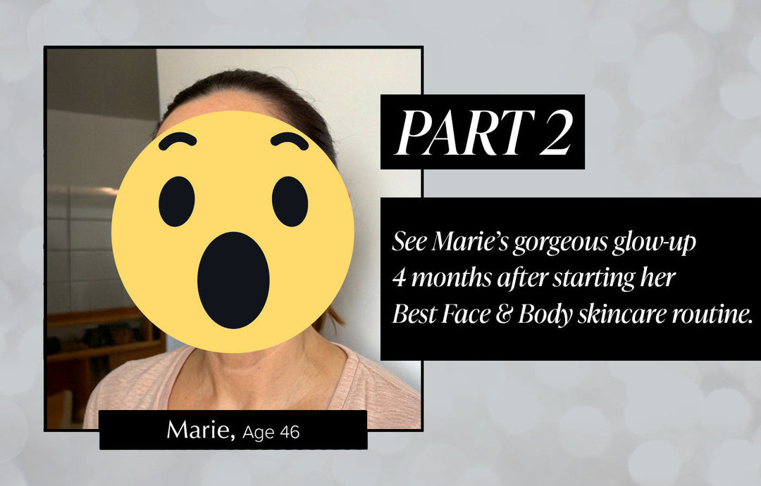 Marie's Skincare Journey - Part 2
