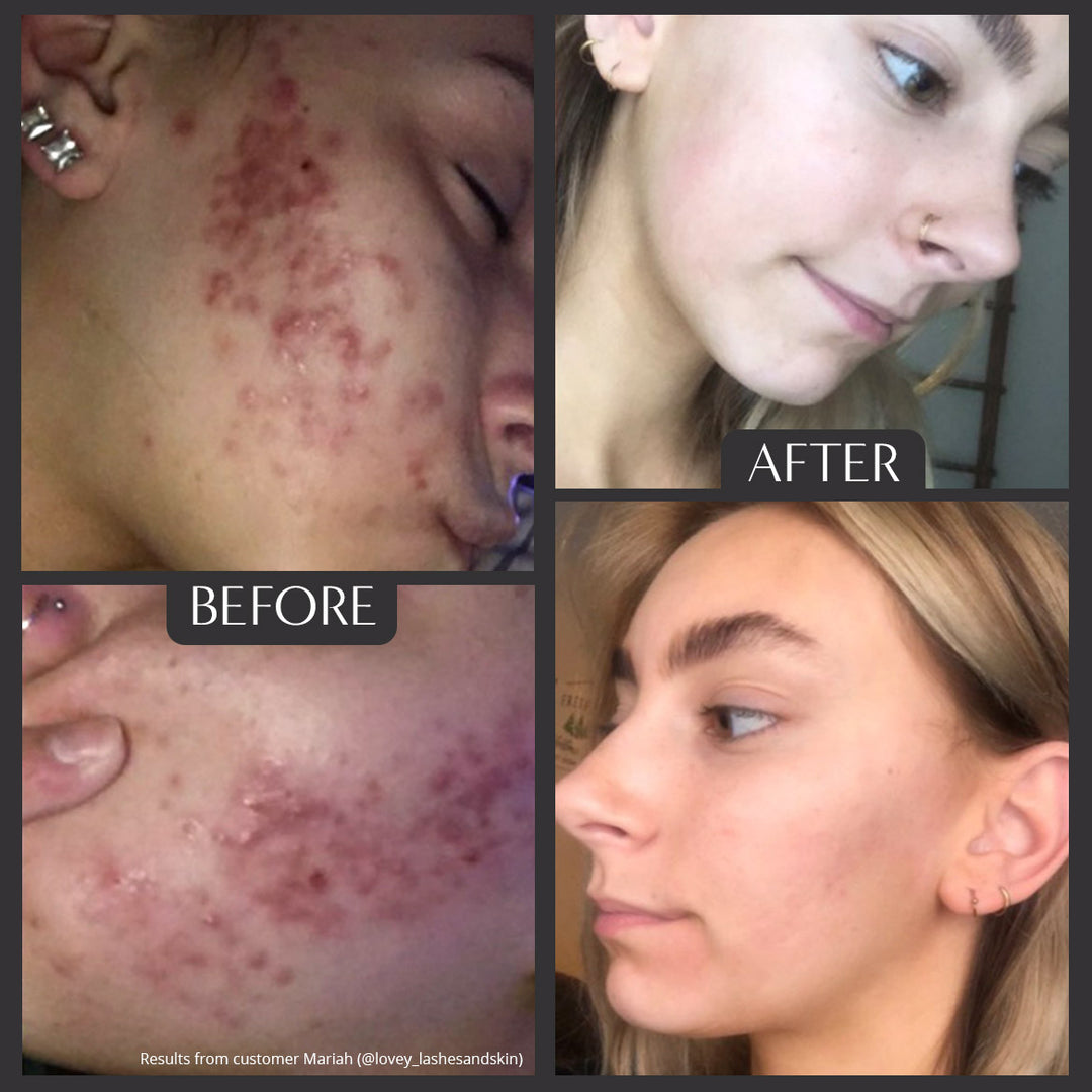 AHA/BHA Exfoliant Cleanser